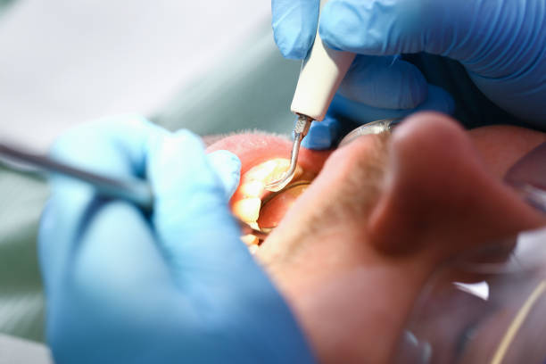 Best Pediatric Emergency Dentist in Oglesby, IL